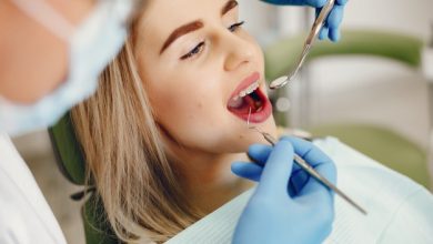Dental Implants