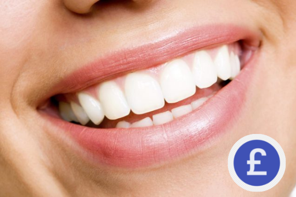 Professional Teeth Whitening Cost