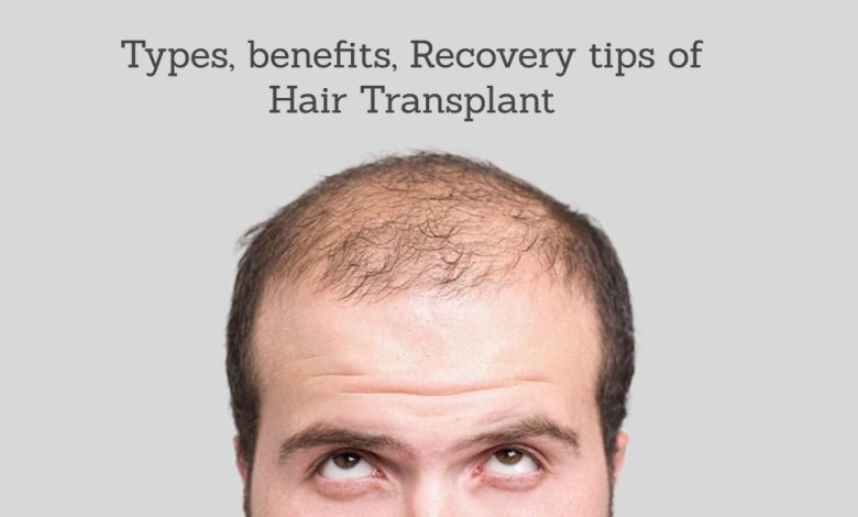 Hair Clinic near me