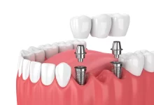 periodontists Ontario