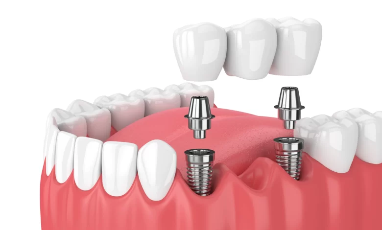 periodontists Ontario